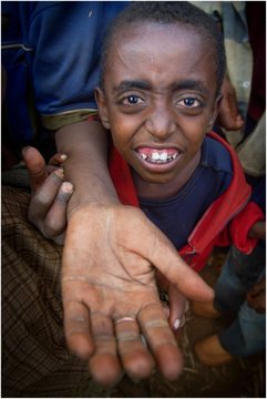 Etiopia